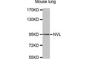 Western Blotting (WB) image for anti-Nuclear VCP-Like (NVL) antibody (ABIN1875763) (NVL anticorps)