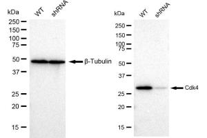 Western blotting analysis using Cdk4 antibody (ABIN7798213). (Recombinant CDK4 anticorps)