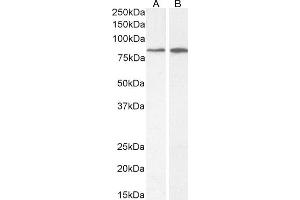 (ABIN7505831) (2 μg/mL) staining of A549 (A) and Caco-2 (B) cell lysate (35 μg protein in RIPA buffer). (Phospholipase C delta 3 anticorps  (AA 261-274))