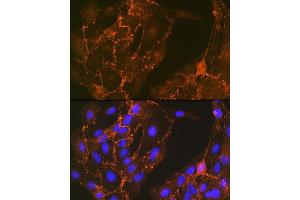 Immunofluorescence analysis of C6 cells using Cortactin Rabbit mAb (ABIN7266511) at dilution of 1:100 (40x lens).