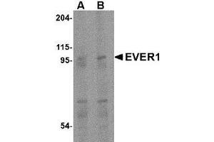 Western blot analysis of EVER1 in human spleen tissue lysate with AP30322PU-N EVER1 antibody at (A) 1 and (B) 2 μg/ml. (TMC6 anticorps  (Center))