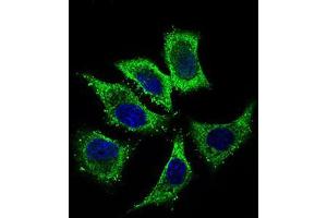 Immunofluorescence analysis of HepG2 cells using ALDH2 mouse mAb (green). (ALDH2 anticorps  (AA 317-517))