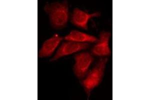 ABIN6275929 staining 293T by IF/ICC. (S1PR1 anticorps  (Internal Region))