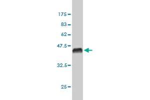 Western Blot detection against Immunogen (36. (Exportin 2 anticorps  (AA 872-971))