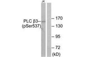 Western blot analysis of extracts from Jurkat cells treated with UV 15', using PLC beta3 (Phospho-Ser537) Antibody. (PLCB3 anticorps  (pSer537))