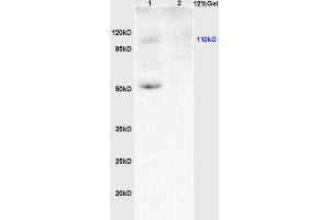 L1 rat brain lysates L2 human colon carcinoma lysates probed with Anti KLF5/UKHC Polyclonal Antibody, Unconjugated (ABIN739515) at 1:200 overnight at 4 °C.