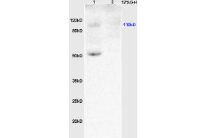 L1 rat brain lysates L2 human colon carcinoma lysates probed with Anti KLF5/UKHC Polyclonal Antibody, Unconjugated (ABIN739515) at 1:200 overnight at 4 °C. (KLF5 anticorps  (AA 61-160))