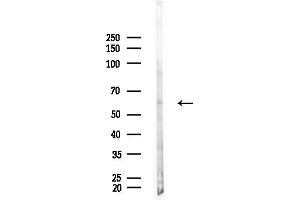 anti-Interleukin 10 Receptor, alpha (IL10RA) (C-Term) antibody