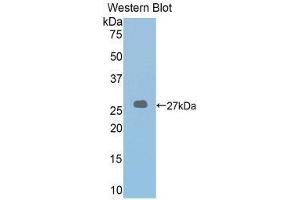 Western Blotting (WB) image for anti-Lysyl Oxidase-Like 2 (LOXL2) (AA 553-761) antibody (ABIN1859687) (LOXL2 anticorps  (AA 553-761))