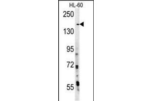 anti-PH Domain and Leucine Rich Repeat Protein Phosphatase 2 (PHLPP2) (AA 4-31), (N-Term) antibody