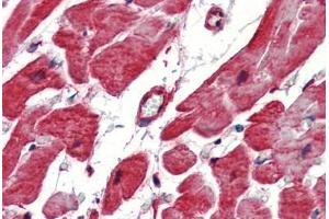 Human Heart (formalin-fixed, paraffin-embedded) stained with Heat Shock Protein 27 (HSP27) antibody ABIN462101 at 10 ug/ml followed by biotinylated goat anti-rabbit IgG secondary antibody ABIN481713, alkaline phosphatase-streptavidin and chromogen. (HSP27 anticorps)