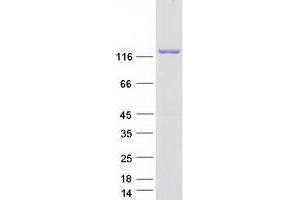 Validation with Western Blot