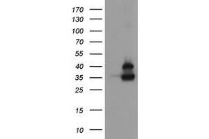Image no. 1 for anti-OTU Domain, Ubiquitin Aldehyde Binding 1 (OTUB1) antibody (ABIN1499929) (OTUB1 anticorps)