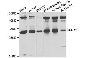 Western blot analysis of extracts of various cell lines, using CDK2 antibody. (CDK2 anticorps)