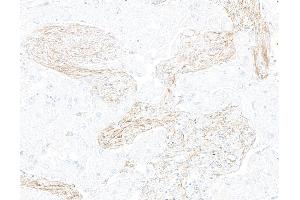 Immunohistochemistry (IHC) image for anti-Leucine Rich Repeat Containing 15 (LRRC15) (AA 22-538) antibody (ABIN7795791)