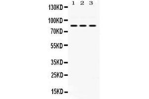 Western blot analysis of KRIT1 expression in rat cardiac muscle extract ( Lane 1), NIH3T3 whole cell lysates ( Lane 2) and HELA whole cell lysates ( Lane 3). (KRIT1 anticorps  (C-Term))