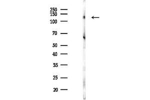 anti-Stonin 2 (STON2) antibody