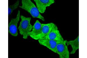 Immunofluorescence analysis of BT-20 cells using MCL1 antibody (ABIN4904325). (MCL-1 anticorps)