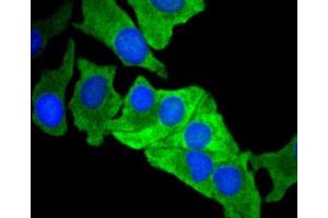 Immunofluorescence analysis of BT-20 cells using MCL1 antibody (ABIN4904325).