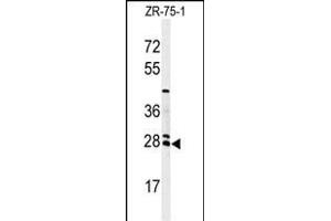 Western blot analysis of NAT8 Antibody (Center) (ABIN651148 and ABIN2840099) in ZR-75-1 cell line lysates (35 μg/lane). (NAT8 anticorps  (AA 110-138))