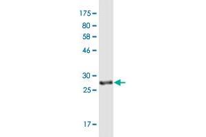 Western Blot detection against Immunogen (29.