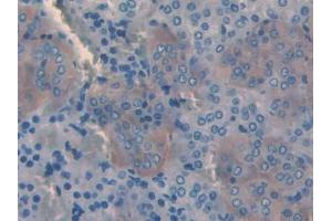 DAB staining on IHC-P; Samples: Rat Adrenal gland Tissue