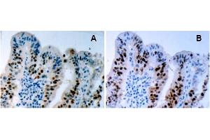 Immunohistochemistry (IHC) image for anti-Tumor Protein P53 (TP53) (AA 378-393), (pSer392) antibody (ABIN487475)