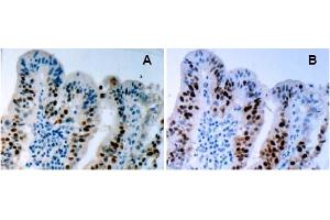 Immunohistochemistry (IHC) image for anti-Tumor Protein P53 (TP53) (AA 378-393), (pSer392) antibody (ABIN487475) (p53 anticorps  (pSer392))