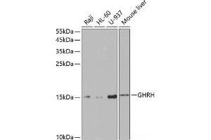 Western blot analysis of extracts of various cell lines using GHRH Polyclonal Antibody at dilution of 1:1000. (GHRH anticorps)