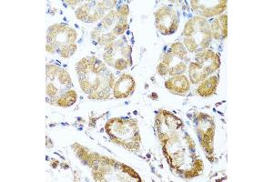 Immunohistochemistry of paraffin-embedded human stomach using PER1 antibody (ABIN5974860) at dilution of 1/100 (40x lens). (PER1 anticorps)
