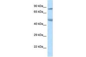 Image no. 1 for anti-Zinc Finger Protein 90 (ZNF90) (AA 49-98) antibody (ABIN6747510) (ZNF90 anticorps  (AA 49-98))