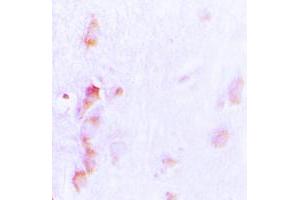 anti-Cell Division Cycle Associated 3 (CDCA3) (C-Term) antibody