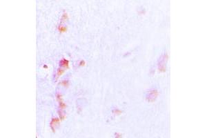 Immunohistochemical analysis of CDCA3 staining in human brain formalin fixed paraffin embedded tissue section. (CDCA3 anticorps  (C-Term))