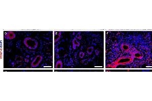 Increased expression of lymphangiogenic mediators in minor salivary glands (MSGs) from patients with primary Sjögren's syndrome (pSS).