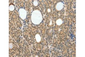 Immunohistochemistry (IHC) image for anti-Neurogenin 3 (NEUROG3) (AA 1-83) antibody (ABIN3016654)