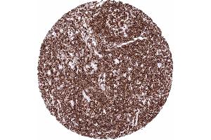 In the lymph node virtually all hematolymphoid cells are CD45 positive