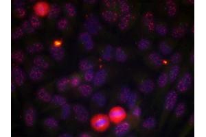 Immunofluorescence staining of methanol-fixed HeLa cells using Elk-1 (phospho-Thr417) antibody. (ELK1 anticorps  (pThr417))