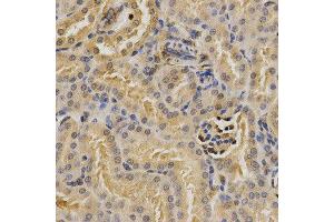Immunohistochemistry (IHC) image for anti-Proteasome (Prosome, Macropain) 26S Subunit, Non-ATPase, 9 (PSMD9) antibody (ABIN1876545) (PSMD9 anticorps)
