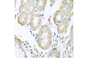 Immunohistochemistry of paraffin-embedded human stomach using ACAD9 antibody at dilution of 1:100 (x40 lens). (ACAD9 anticorps)