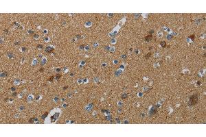 Immunohistochemistry of paraffin-embedded Human brain tissue using PPARGC1B Polyclonal Antibody at dilution 1:30 (PPARGC1B anticorps)