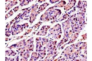 Immunohistochemistry of paraffin-embedded human pancreatic tissue using ABIN7168925 at dilution of 1:100 (SPINK1 anticorps  (AA 19-79))