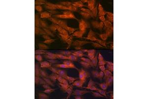 Immunofluorescence analysis of C6 cells using Laminin beta 1 Rabbit mAb (ABIN7268185) at dilution of 1:100 (40x lens).