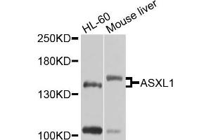 Western blot analysis of extracts of various cells, using ASXL1 antibody. (ASXL1 anticorps)