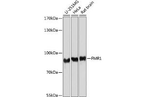 Western blot analysis of extracts of various cell lines, using FMRP antibody (ABIN6133703, ABIN6140719, ABIN6140721 and ABIN6221705) at 1:1000 dilution. (FMR1 anticorps  (AA 500-600))
