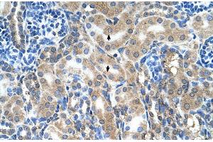 Rabbit Anti-ABP1 Antibody ,Paraffin Embedded Tissue: Human Kidney  Cellular Data: Epithelial cells of renal tubule  Antibody Concentration: 4. (DAO anticorps  (C-Term))