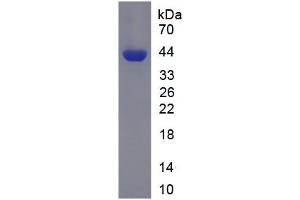 SDS-PAGE analysis of Human PFKL Protein. (PFKL Protéine)