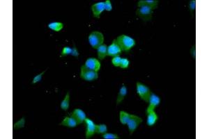 Immunofluorescence staining of SH-SY5Y cells with ABIN7148040 at 1:100, counter-stained with DAPI. (Codanin 1 (CDNA1) (AA 62-249) anticorps)