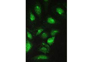 IF analysis of CCT2 using anti-CCT2 antibody (ABIN4886512).