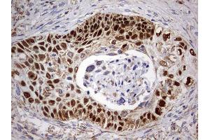 Immunohistochemistry (IHC) image for anti-Tumor Protein P63 (TP63) antibody (ABIN2673817)