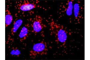 Proximity Ligation Analysis of protein-protein interactions between CALR and F8.